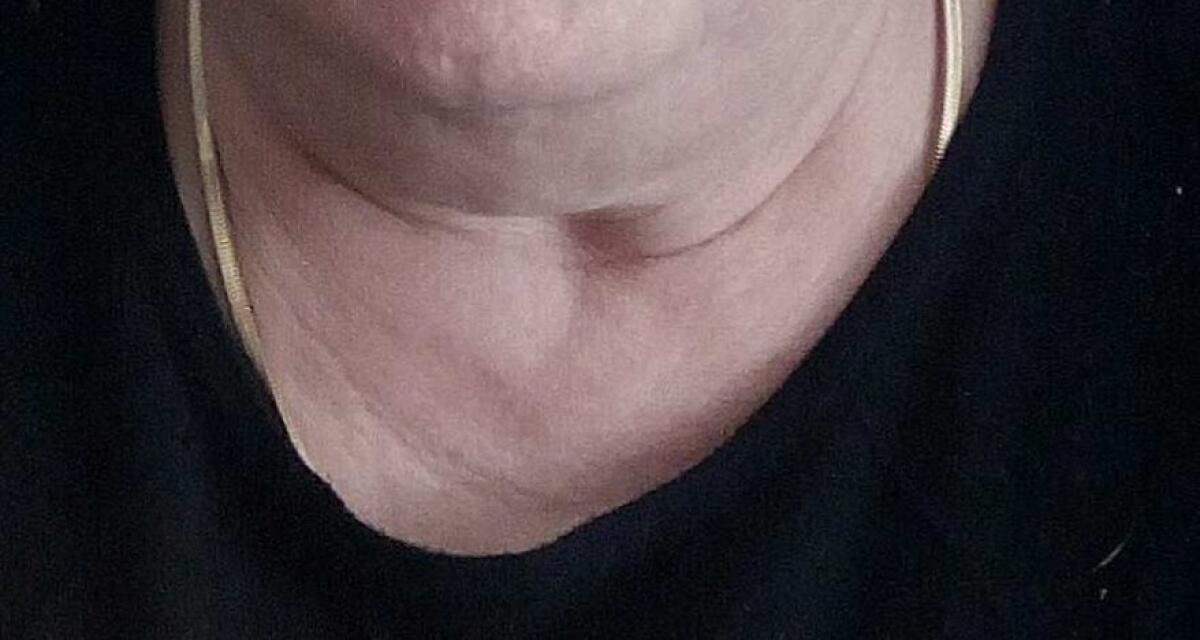 PATERNO': ANZIANA DERUBATA E FERITA IN VIA UDINE - 