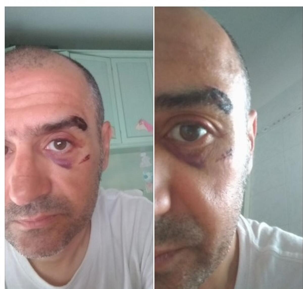 PATERNO': Automobilista colpisce un ciclista con un pugno nei pressi del Ponte Barca - 