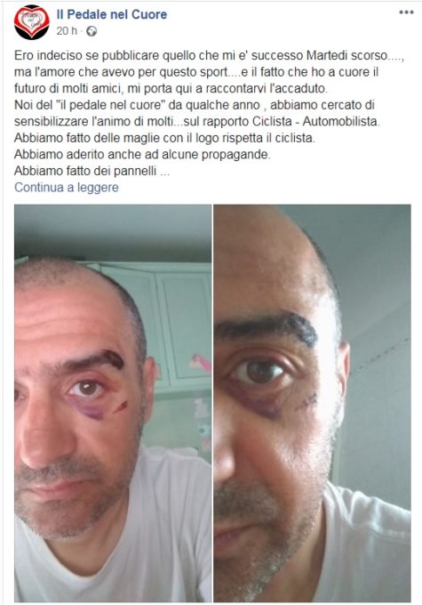 PATERNO': Automobilista colpisce un ciclista con un pugno nei pressi del Ponte Barca