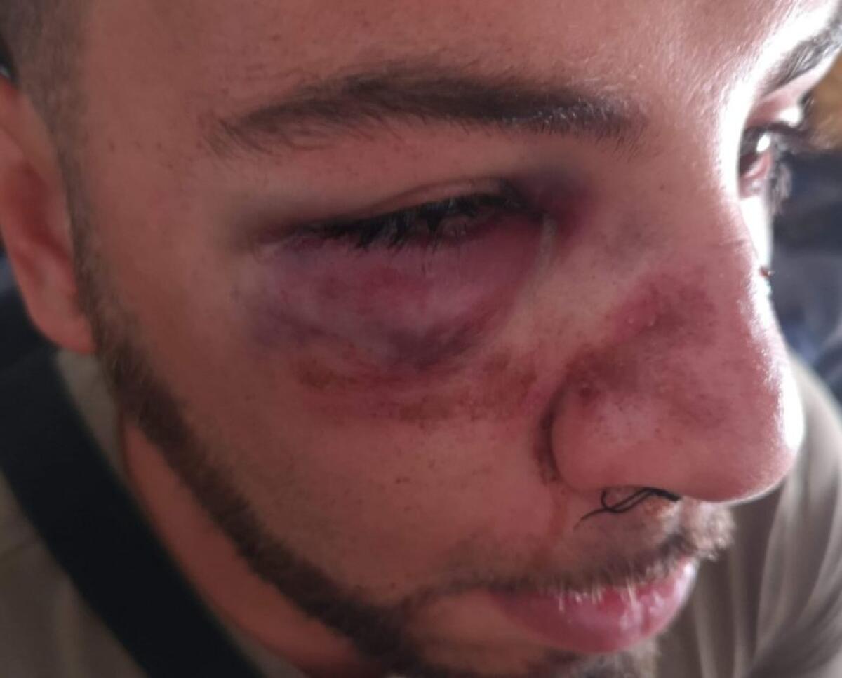 ETNALAND : LO SFOGO DI UN PADRE PER IL FIGLIO PESTATO - 