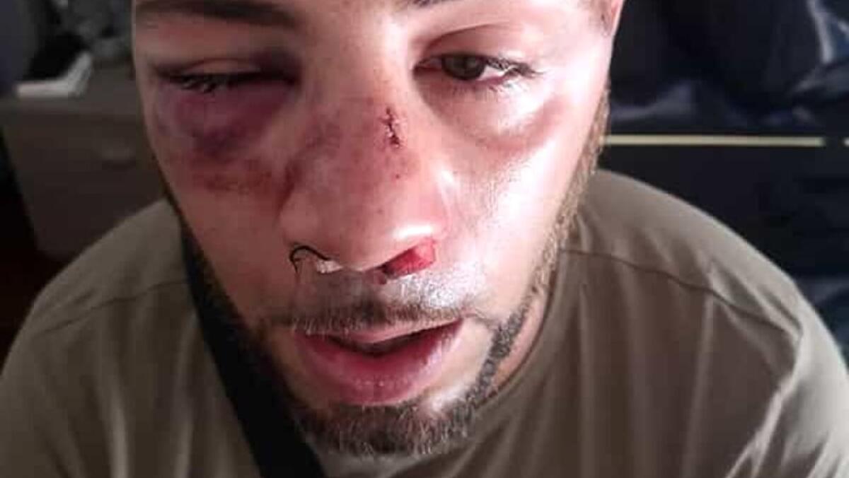 ETNALAND : LO SFOGO DI UN PADRE PER IL FIGLIO PESTATO, LA REPLICA DELLA DIREZIONE - 