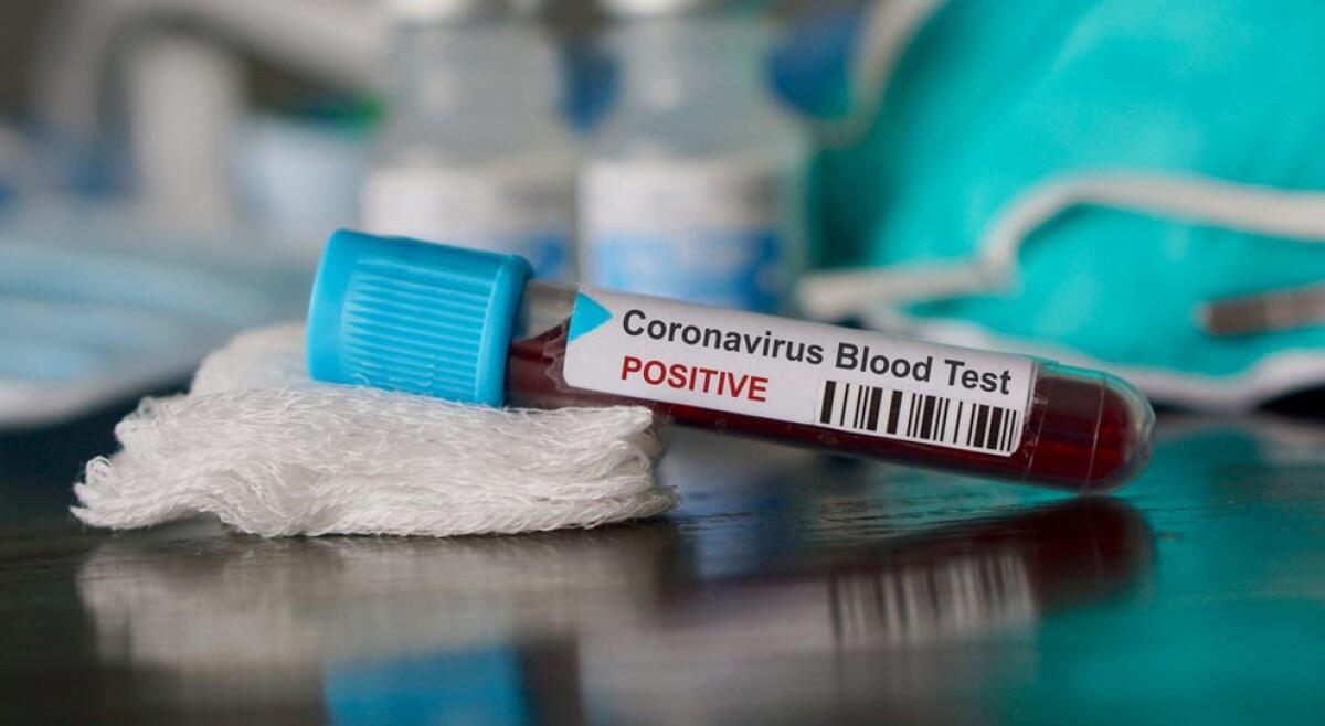 CORONAVIRUS, A SAN GIOVANNI LA PUNTA MORTO L’OSPITE DI UNA CASA DI RIPOSO - 