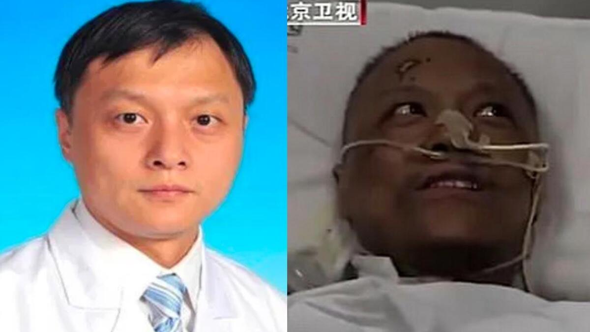 DUE MEDICI CINESI CONTAGIATI DAL VIRUS SI RISVEGLIANO CON LA PELLE SCURA - 