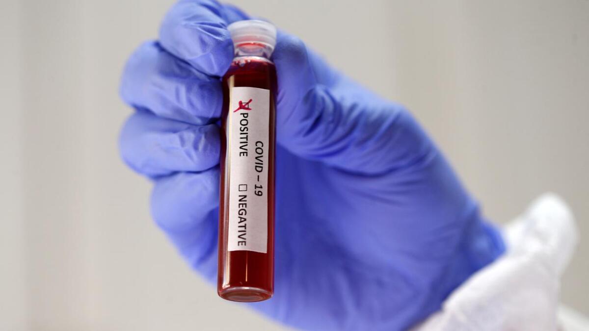 CORONAVIRUS: IN SICILIA TRE NUOVI CONTAGI, CASI IN AUMENTO A LIVELLO NAZIONALE - 