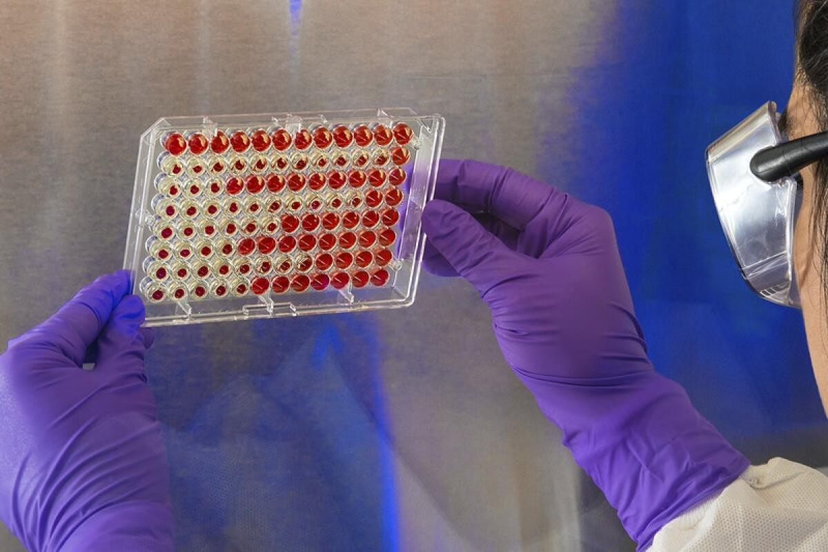 PRIMO CASO MORTALE DI LEGIONELLA A SIRACUSA, DECEDUTA UNA DONNA - 