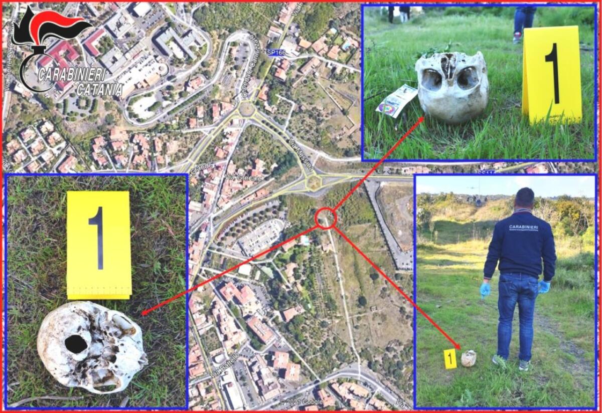 CATANIA,RINVENUTO TESCHIO UMANO AL CANNIZZARO, SI CERCHERÀ DI DARE UN’IDENTITÀ - 