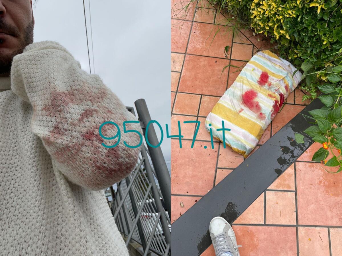 BELPASSO; IL RACCONTO DEL TESTIMONE DELL'ACCOLTELLAMENTO - 