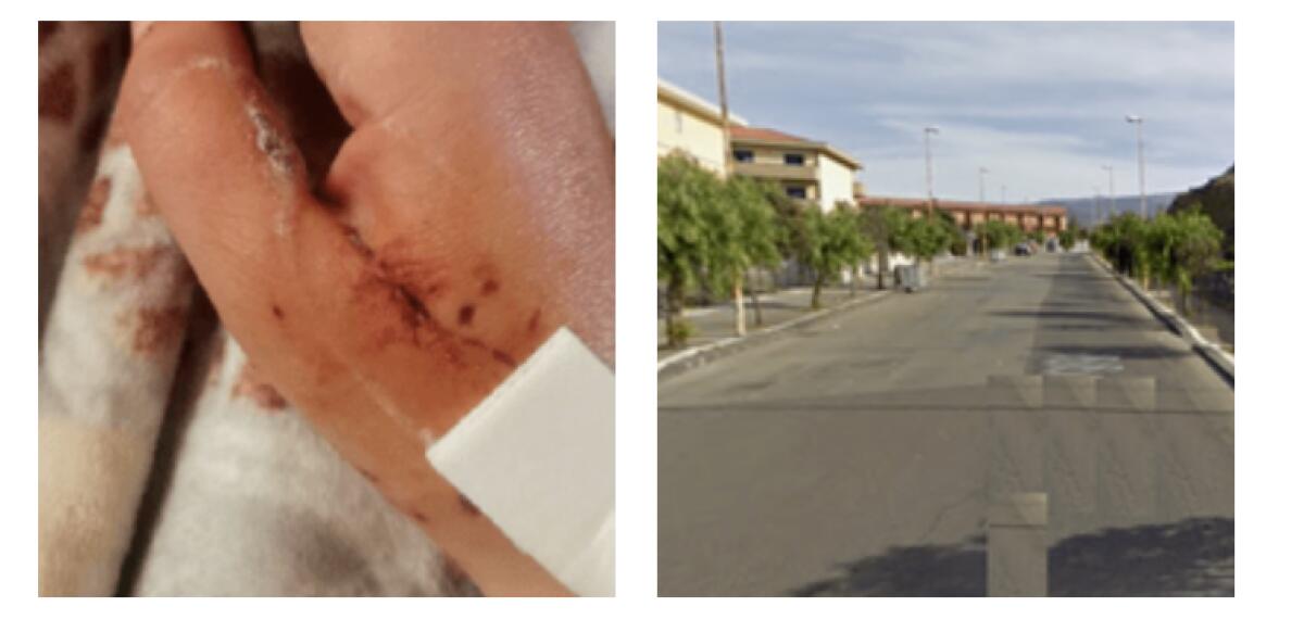 BRONTE: «QUEI CANI CHE HANNO AGGREDITO E FERITO MIA FIGLIA ANCORA OGGI SONO UN RISCHIO PER TUTTI GLI ABITANTI DELLA ZONA» - 