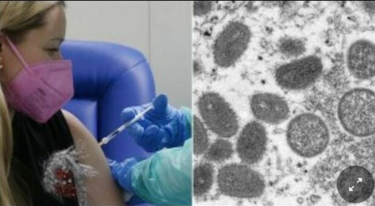 VAIOLO SCIMMIE, MINISTERO ASSEGNA PRIMA TRANCHE VACCINI A 4 REGIONI - 