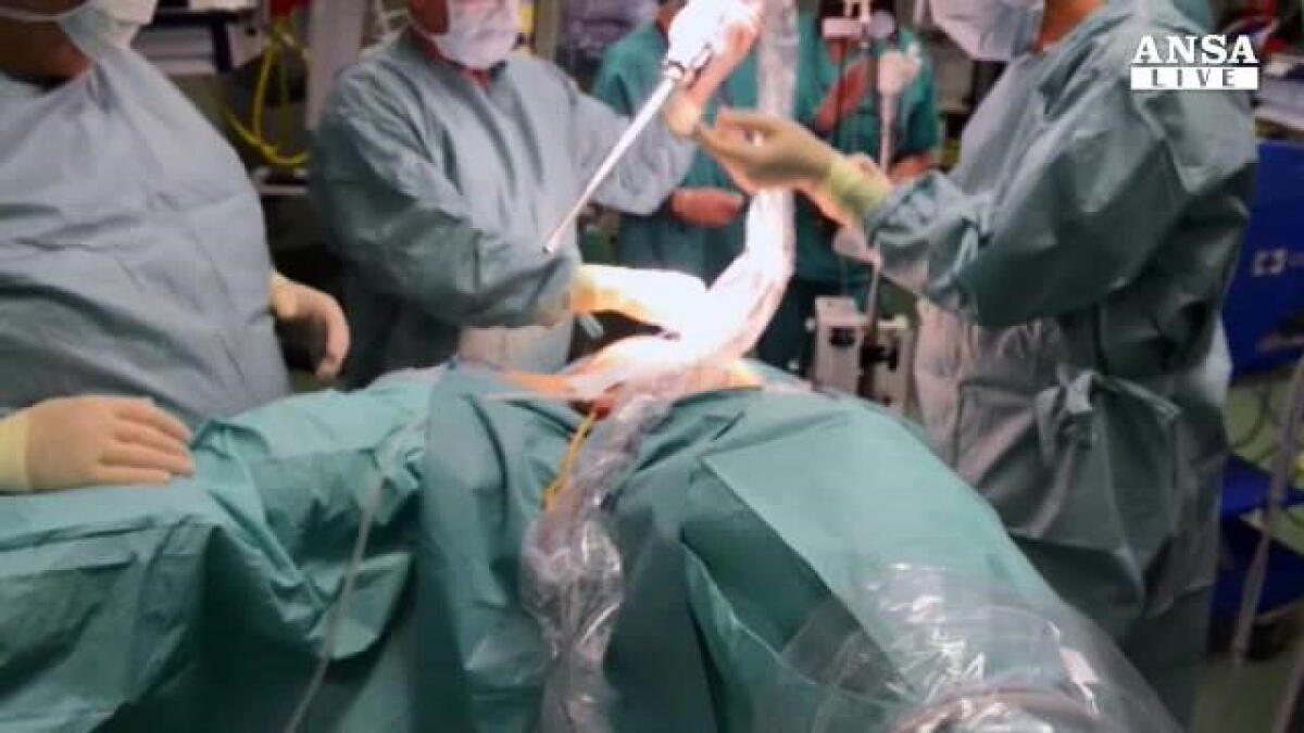 MESSINA, FA INTERVENTO PER DIMAGRIRE: DONNA  MUORE IN OSPEDALE. APERTA UN'INCHIESTA - 