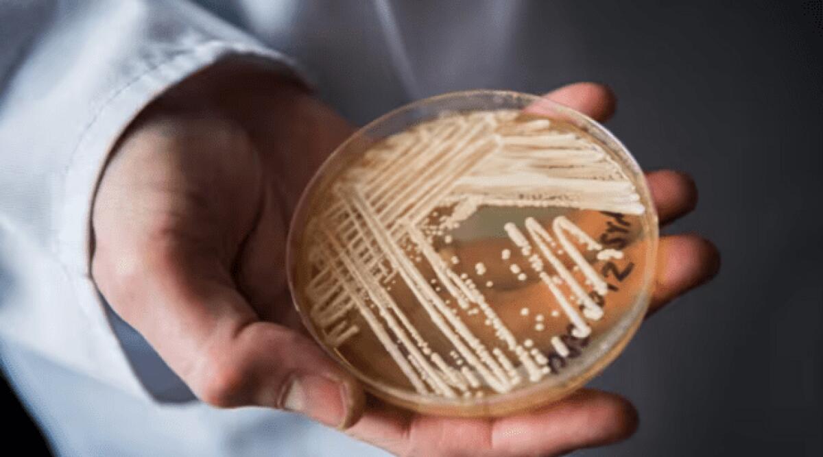 CANDIDA AURIS KILLER, UOMO MORTO A MILANO: «CONTAGIATO DAL FUNGO E DA VARI BATTERI. ARRIVAVA DALLA GRECIA» - 