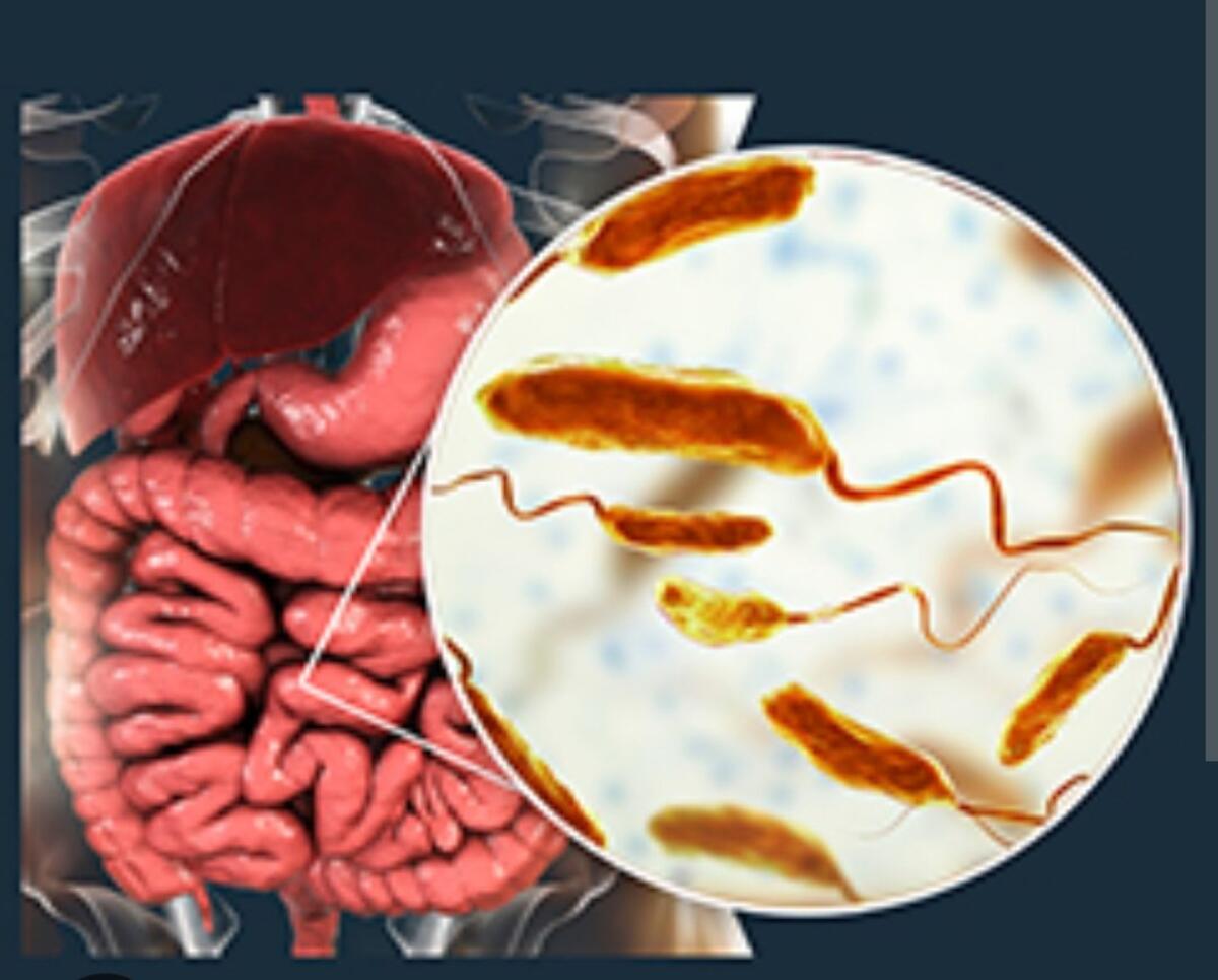 TORNA IL COLERA IN SARDEGNA DOPO 50 ANNI, UN ANZIANO RICOVERATO A CAGLIARI - 