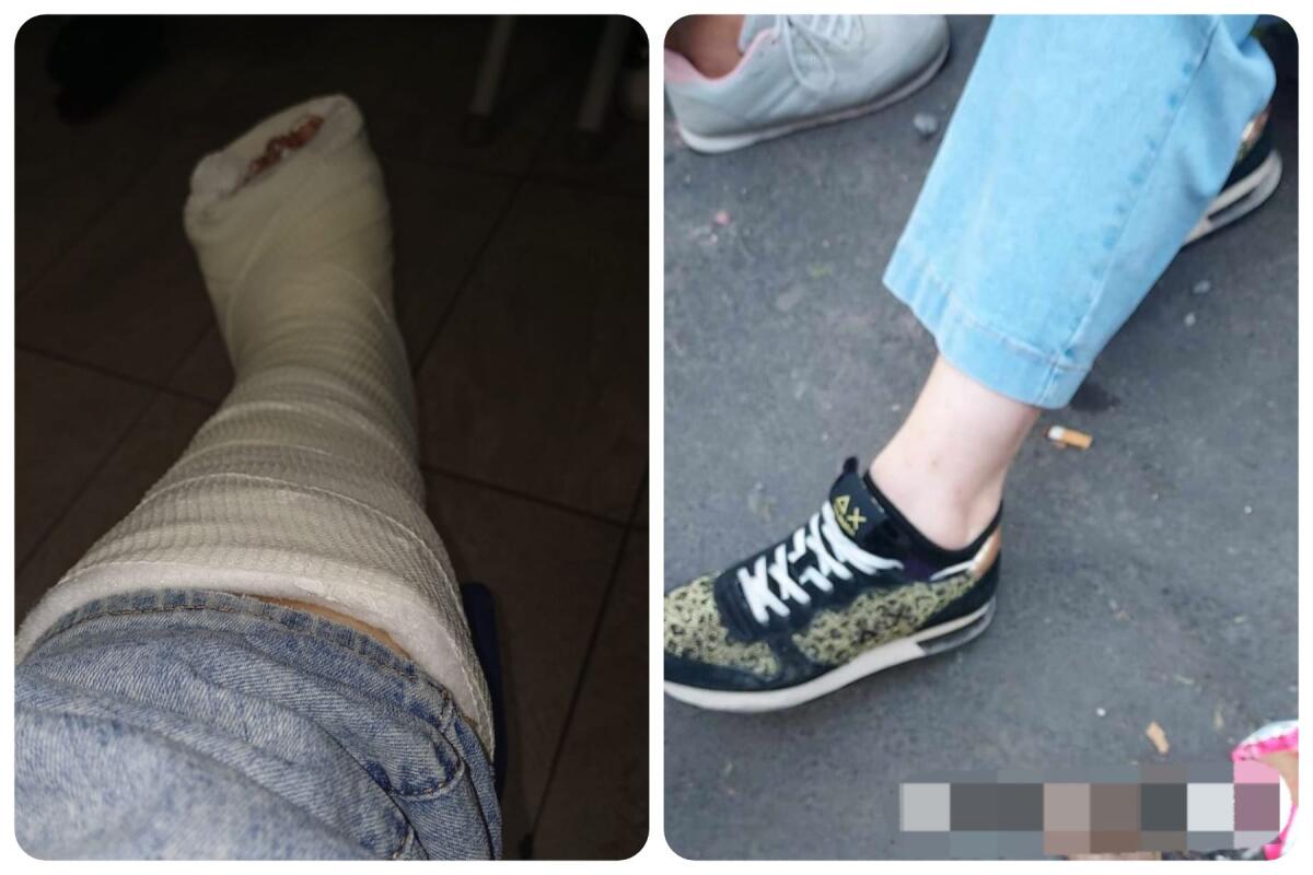 PATERNO' : MAMMA CADE IN UNA BUCA NASCOSTA DAI RIFIUTI E SI FRATTURA UN PIEDE - 