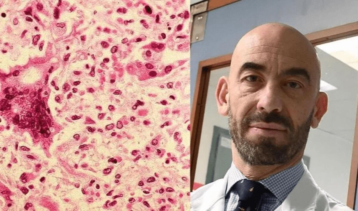 ALLARME MORBILLO. SICILIA MAGLIA NERA INSIEME A LAZIO E TOSCANA. MATTEO BASSETTI : "EPIDEMIA PARTITA, IL PEGGIO DEVE ARRIVARE" - 