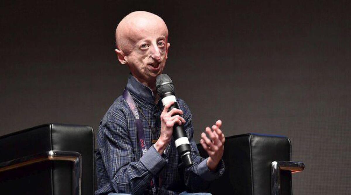 È MORTO SAMMY BASSO, ERA IL MALATO DI PROGERIA PIÙ LONGEVO AL MONDO - 