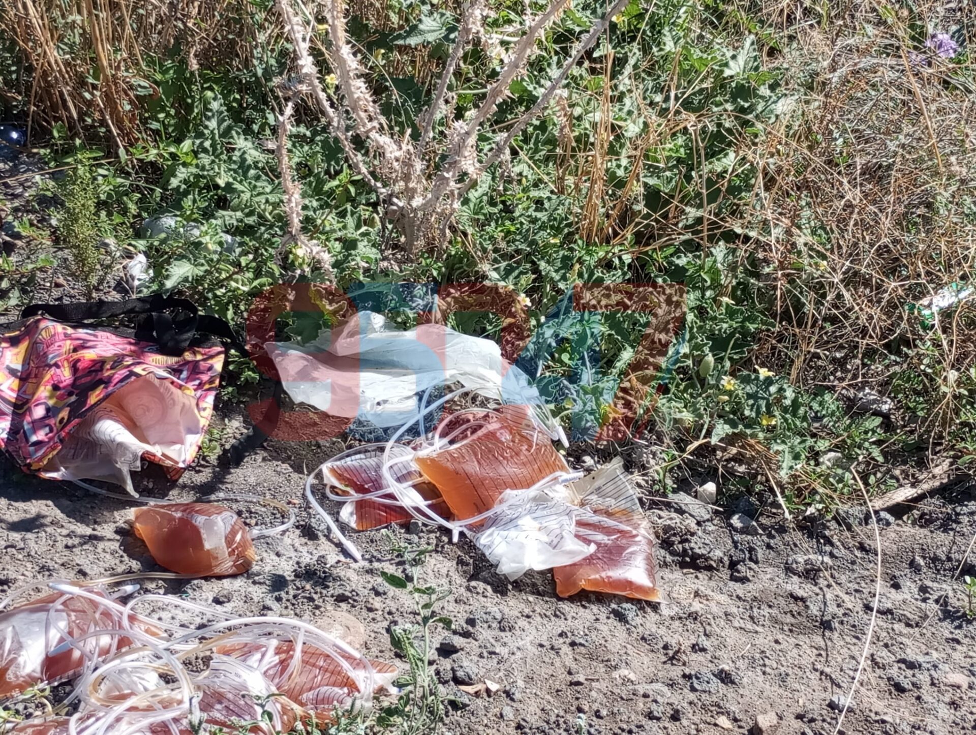 PATERNÒ.  SACCHE CATETERE CON URINA SUL TERRENO: L’INCREDIBILE SCENA DAVANTI ALL'ISTITUTO AGRARIO