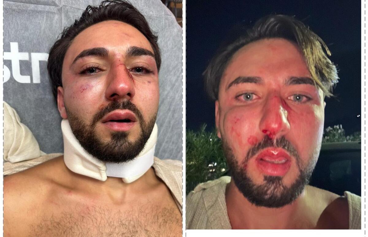 Giovane coppia di Santa Maria di Licodia segnala grave episodio di violenza in un locale notturno a Taormina - 