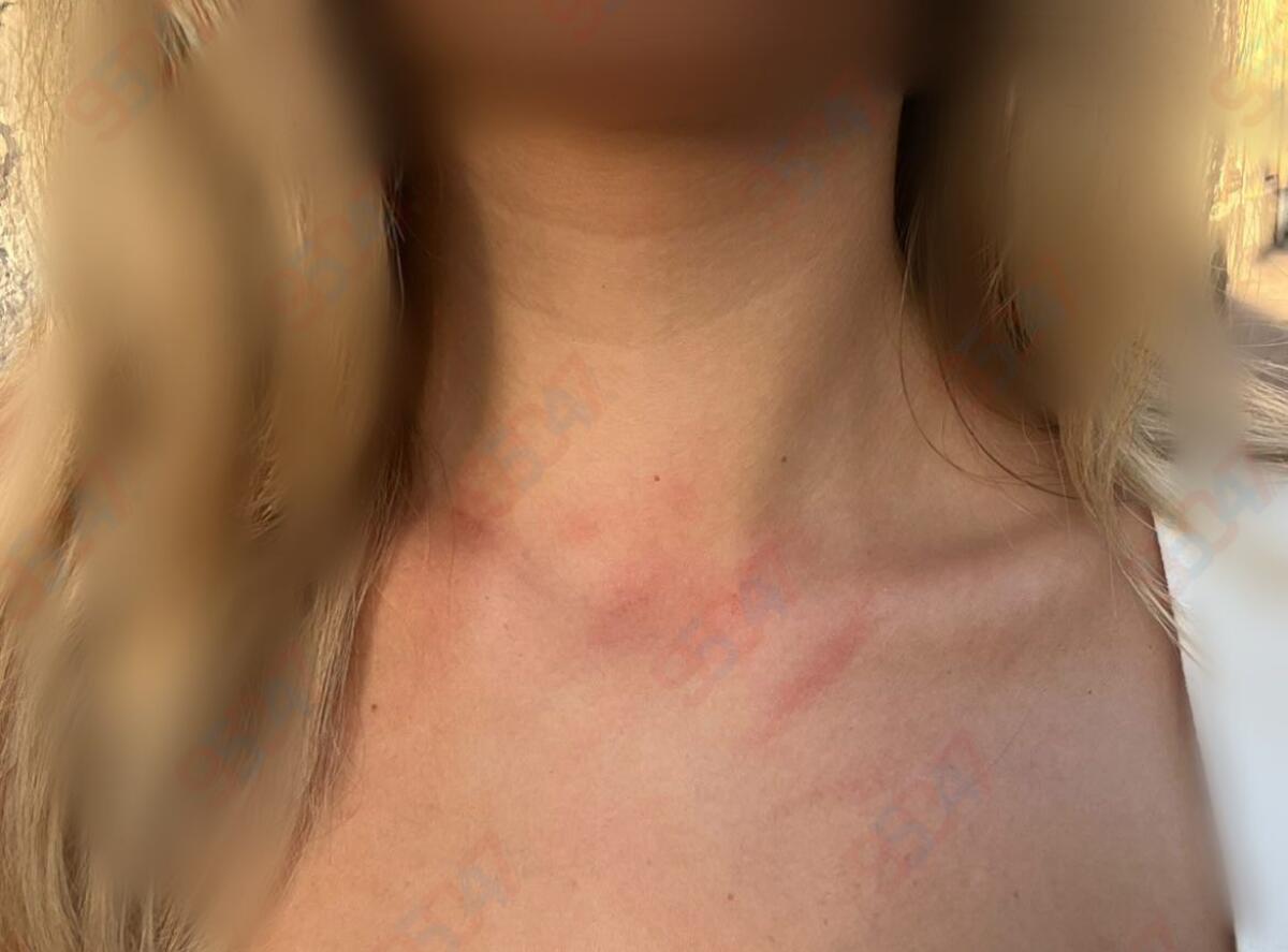 Paternò, ancora un’aggressione in strada: giovane derubata della collana in pieno giorno - 