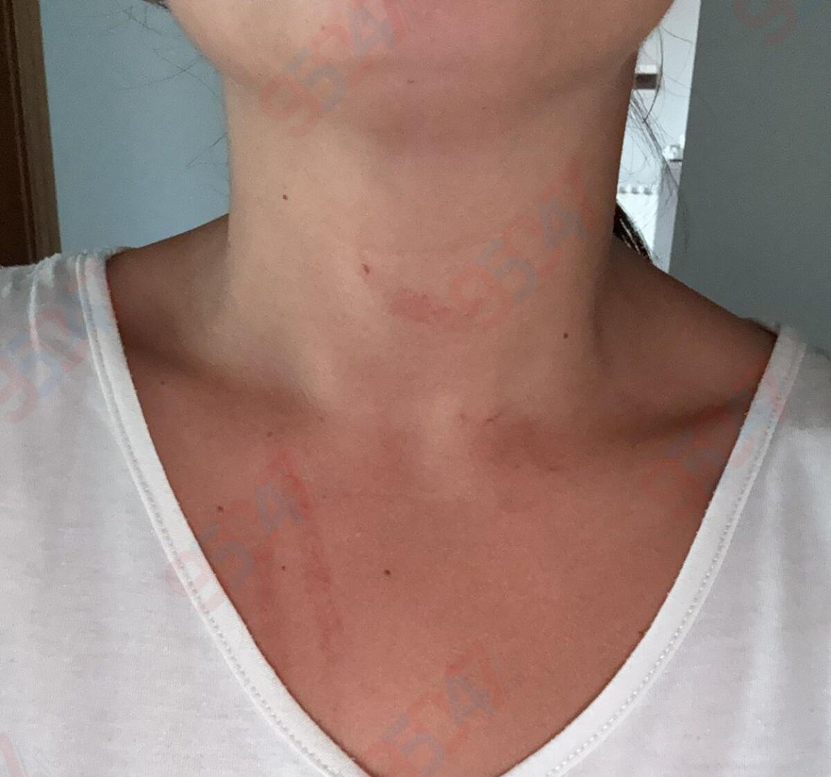 Paternò, donna con la figlia in braccio aggredita e rapinata in pieno giorno - 