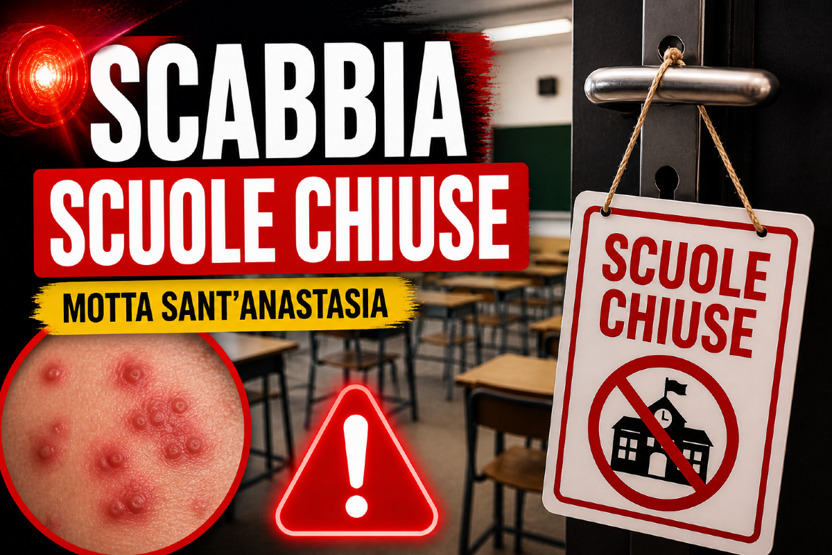 🔴 Allarme scabbia a Motta Sant’Anastasia: scuole chiuse dal 6 all’8 maggio - 