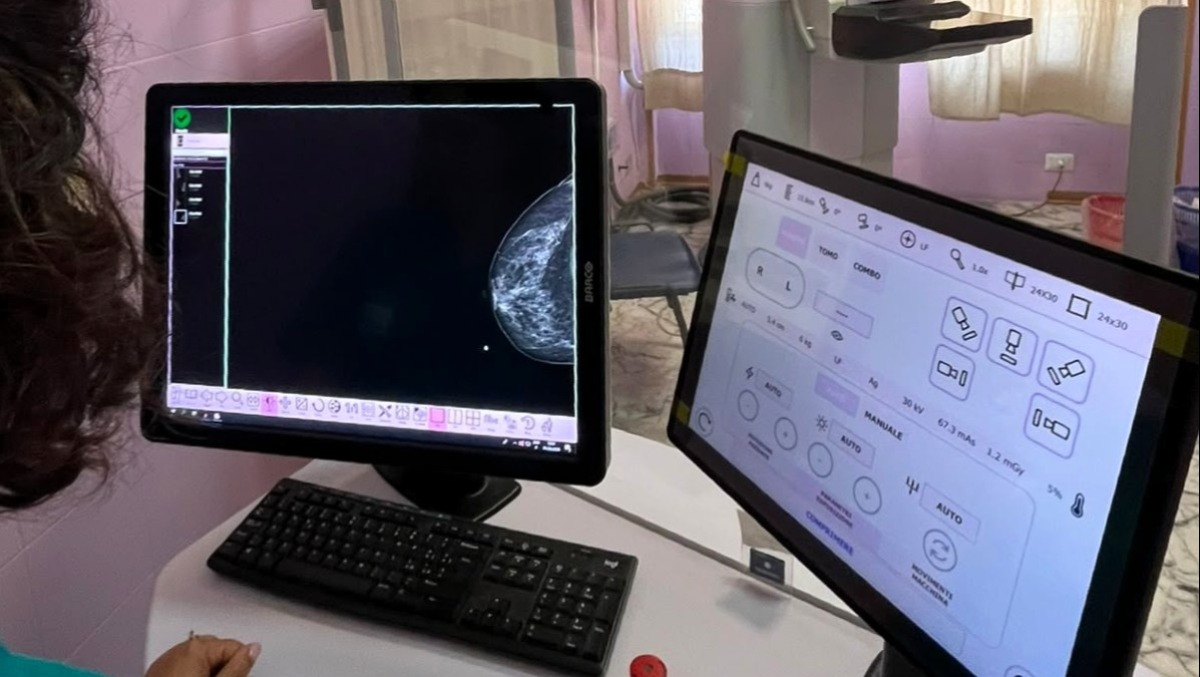 Screening mammografico gratuito, Open Day in tutta la provincia di Catania: ecco date e sedi - 
